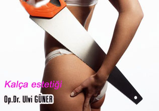 Kalça estetiği