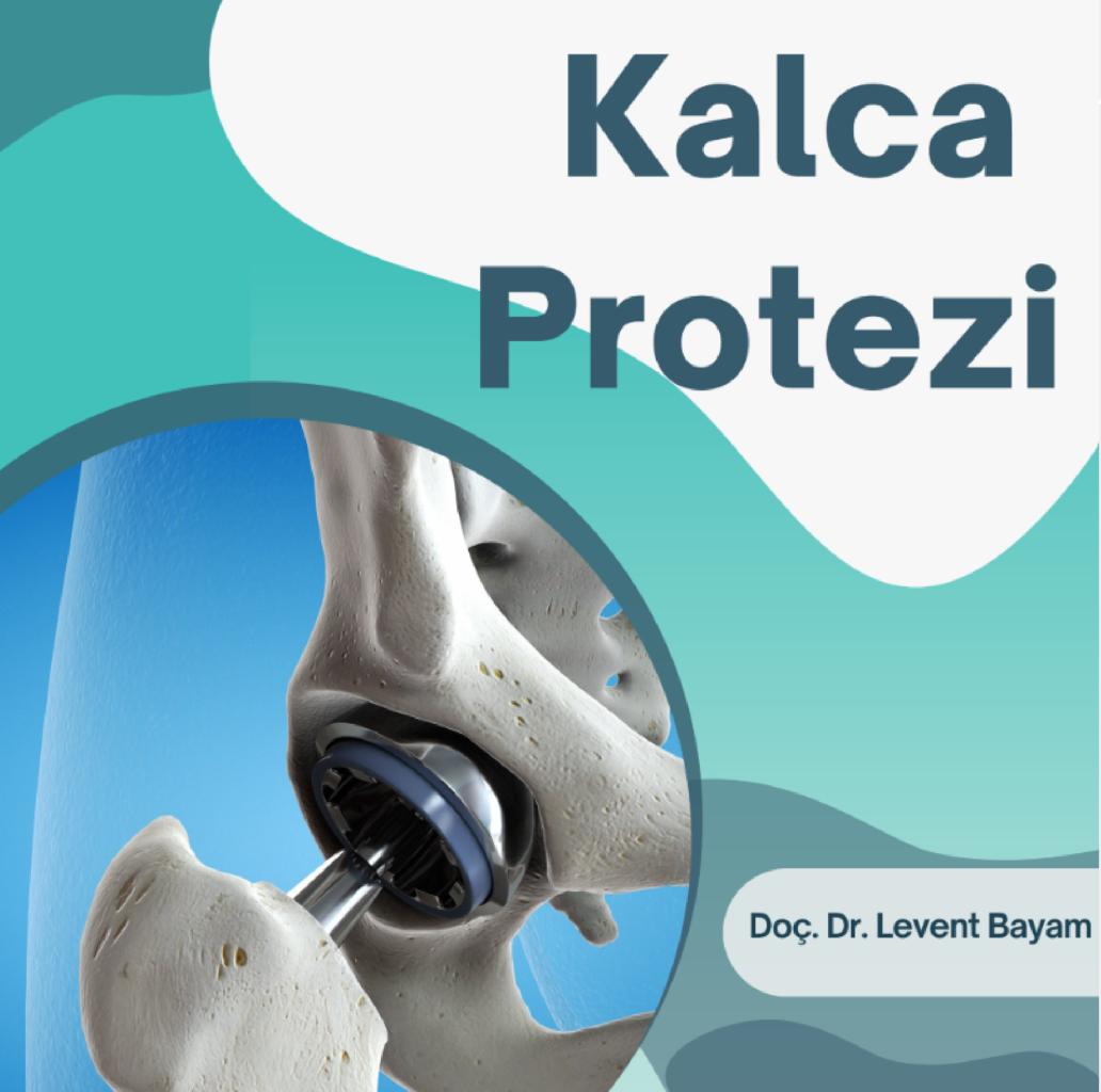 Kalça Protezi makalesi