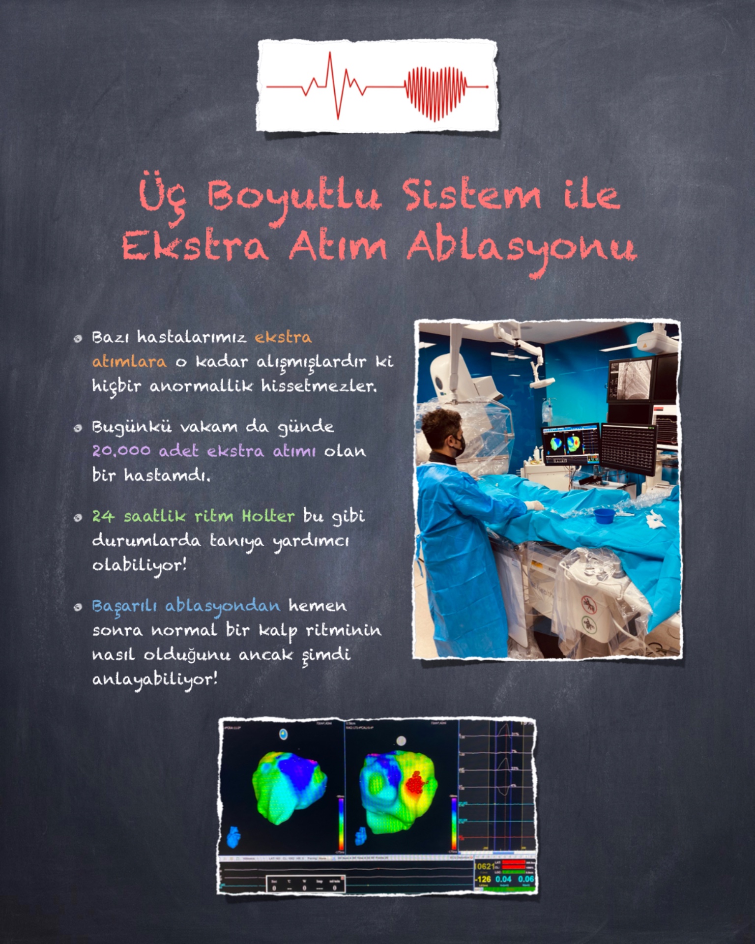 Ritm Bozukluğu Tedavisi: ABLASYON