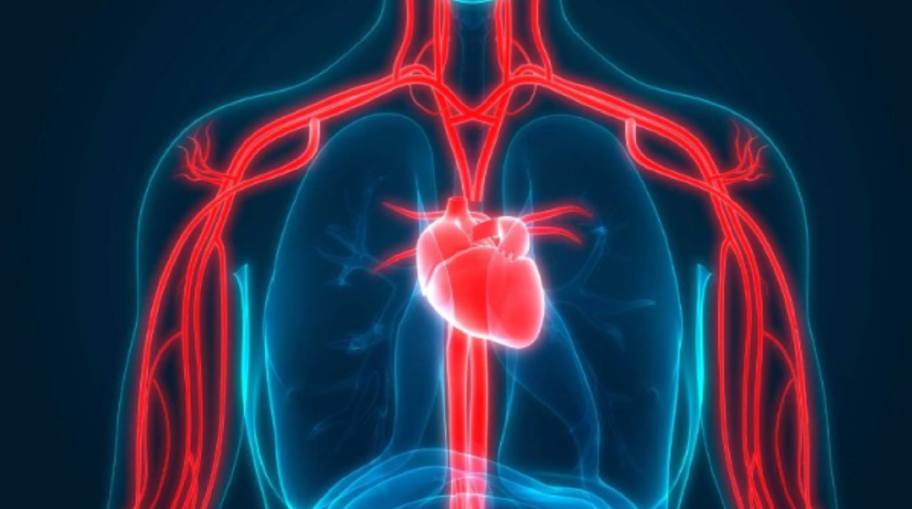 Stent mi, Bypass mı?