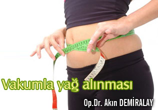 Vakumla yağ alınması ilgili bilgiler