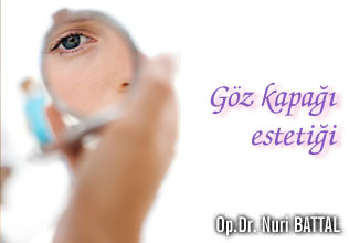 Göz kapağı  estetiği!