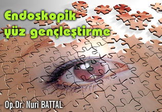 Endoskopik yüz  gençleştirme "İzsiz yüz germe"
