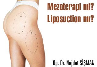 Mezoterapi mi liposuction mı?