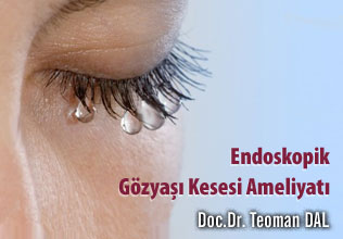 Endoskopik gözyaşı kesesi ameliyatı