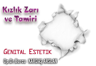 Kızlık zarı dikimi!
