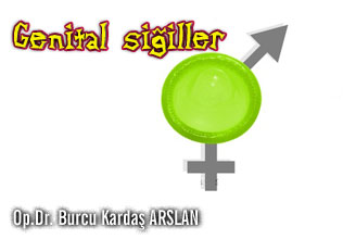 Genital siğiller (kondilom - hpv  enfeksiyonu)
