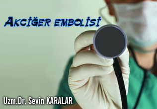 Akciğer embolisi
