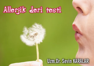 Allerjik deri testi