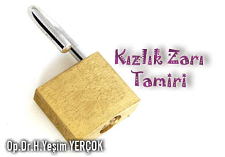 Kızlık zarı tamiri!