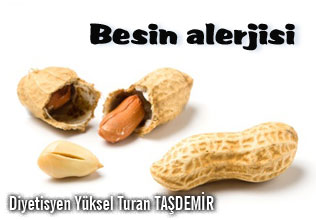 Besin alerjisi ve alerjiye neden olan besinler