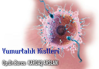 Yumurtalık (over) kisti ve cerrahi operasyon