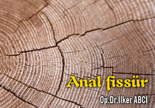 Anal fissür
