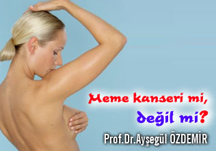 Meme kanseri mi, değil mi?