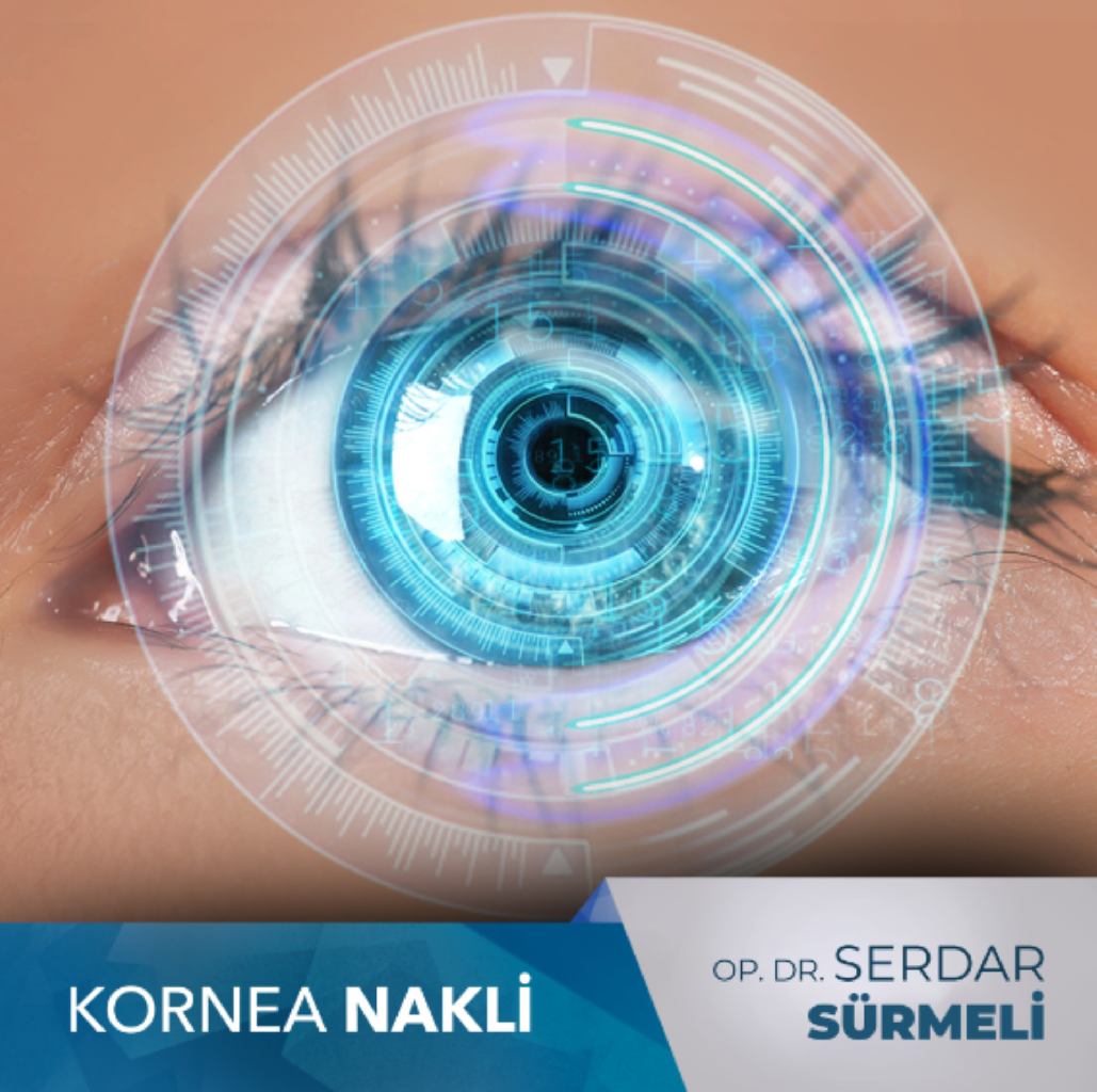 Kornea Nakli