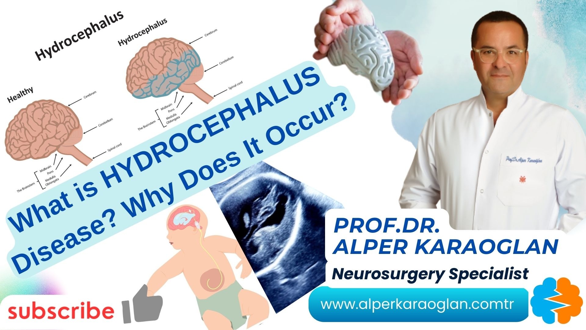 What is HYDROCEPHALUS Disease? Why Does It Occur?