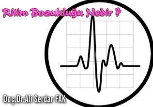 Çarpıntı ve aritmi (ritim bozukluğu ) nedir ?