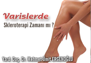 Varislerde skleroterapi zamanı mı ?