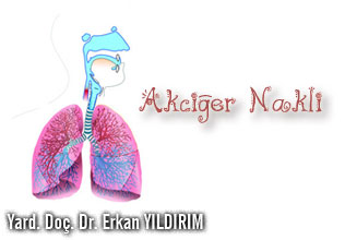 Akciğer nakli (transplantasyon)