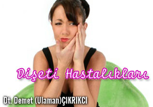 Dişeti hastalıkları (periodontal hastalıklar)