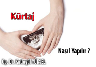 Kürtaj nasıl yapılır? İyileşme süreci nasıldır?
