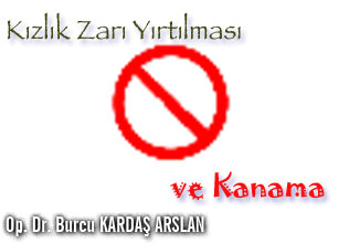 Kızlık zarı yırtılması ve kanama