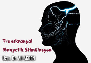 Transkranyal manyetik stimülasyon