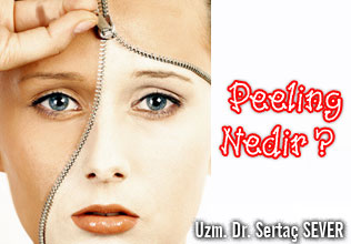 Peeling nedir ?