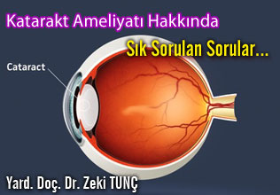 Katarakt ameliyatı hakkında sık sorulan sorular...