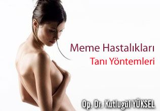 Meme hastalıkları tanı yöntemleri