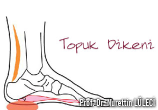 Topuk dikeni,