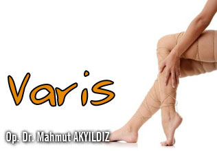 Varis,