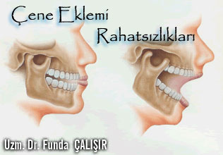 Çene Eklemi Rahatsızlıklarının Belirtileri makalesi
