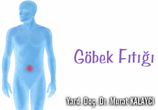 Göbek fıtığında yeni tamir yöntemi