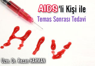 Aıds'li kişi ile temas sonrası tedavi