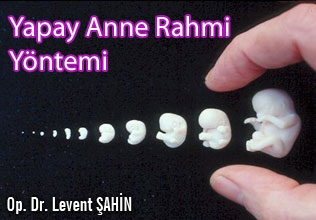 Yapay anne rahmi yöntemi, endometriyal ko-kültür