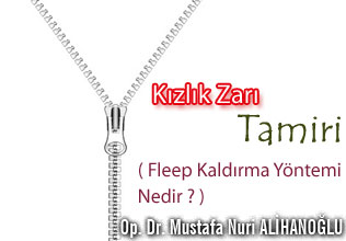 Bekaret ( kızlık zarı ) tamiri ve fleep kaldırma yöntemi nedir ?