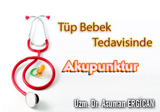 Tüp bebek tedavisinde akupunktur