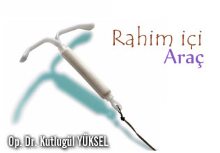 Rahim içi araç