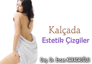 Kalça, Popo ve  Estetik Çizgiler
