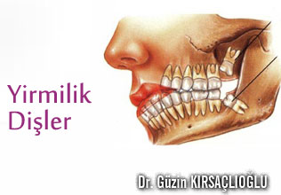 Yirmilik dişler