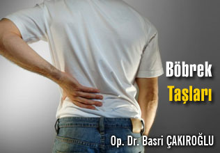 Böbrek taşları