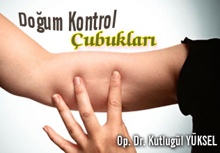 Doğum kontrol çubukları