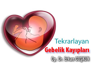 Tekrarlayan Gebelik Kayıpları