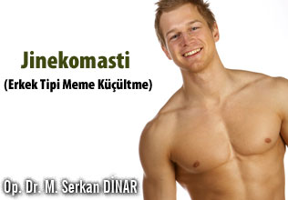 Jinekomasti - erkek tipi meme küçültme
