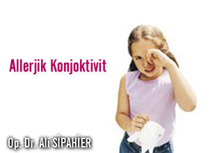 Allerjik konjoktivit makalesi