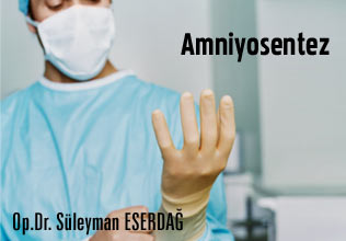 Amniyosentez nasıl yapılrı? Riskleri nelerdir?