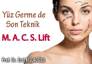 Yüz Germe de Son Teknik M. A. C. S. Lift