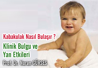 Kabakulak Nasıl Bulaşır ? Klinik Bulgu ve Yan Etkileri