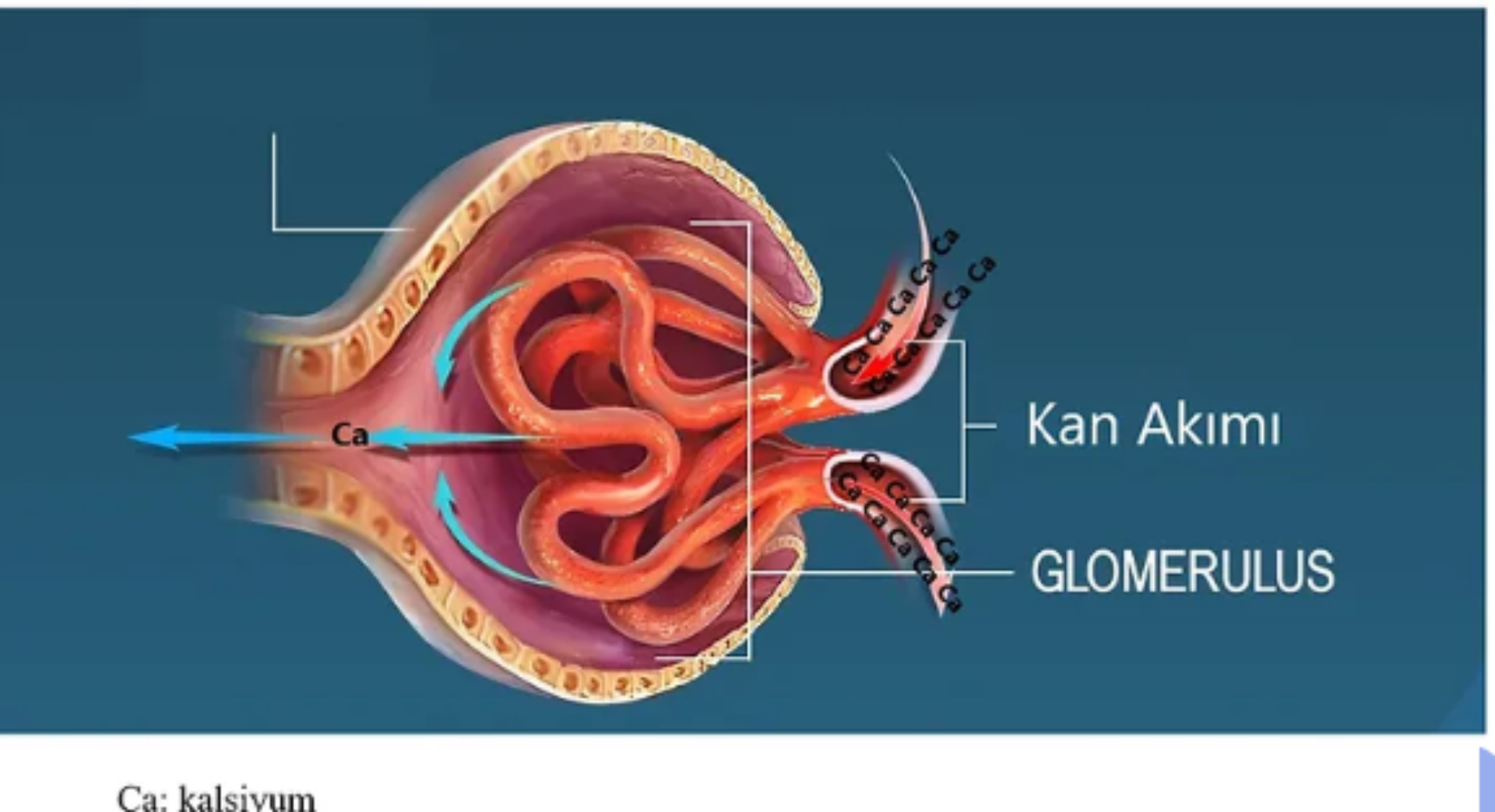 BÖBREK TAŞI NASIL OLUŞUR